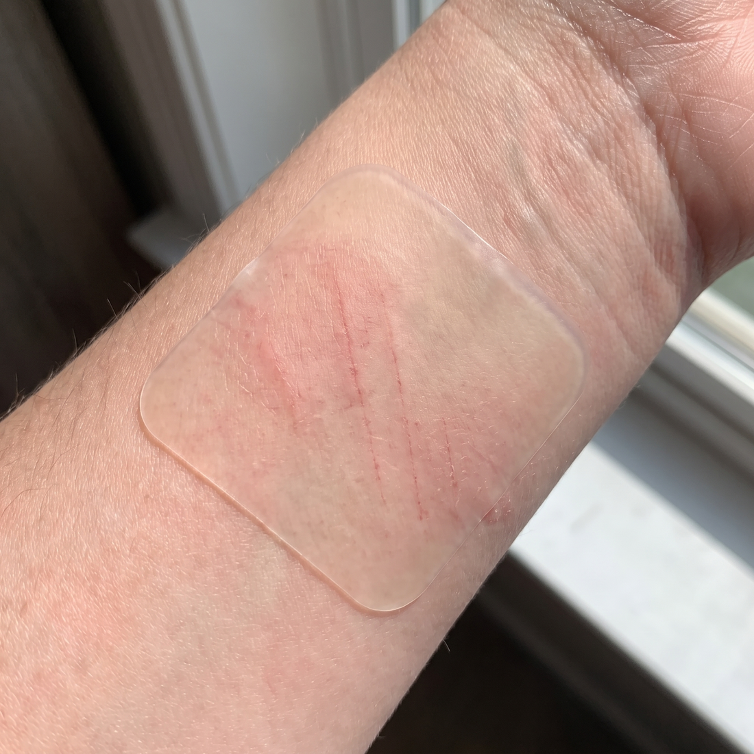 Gentle on the skin that hates everything else.