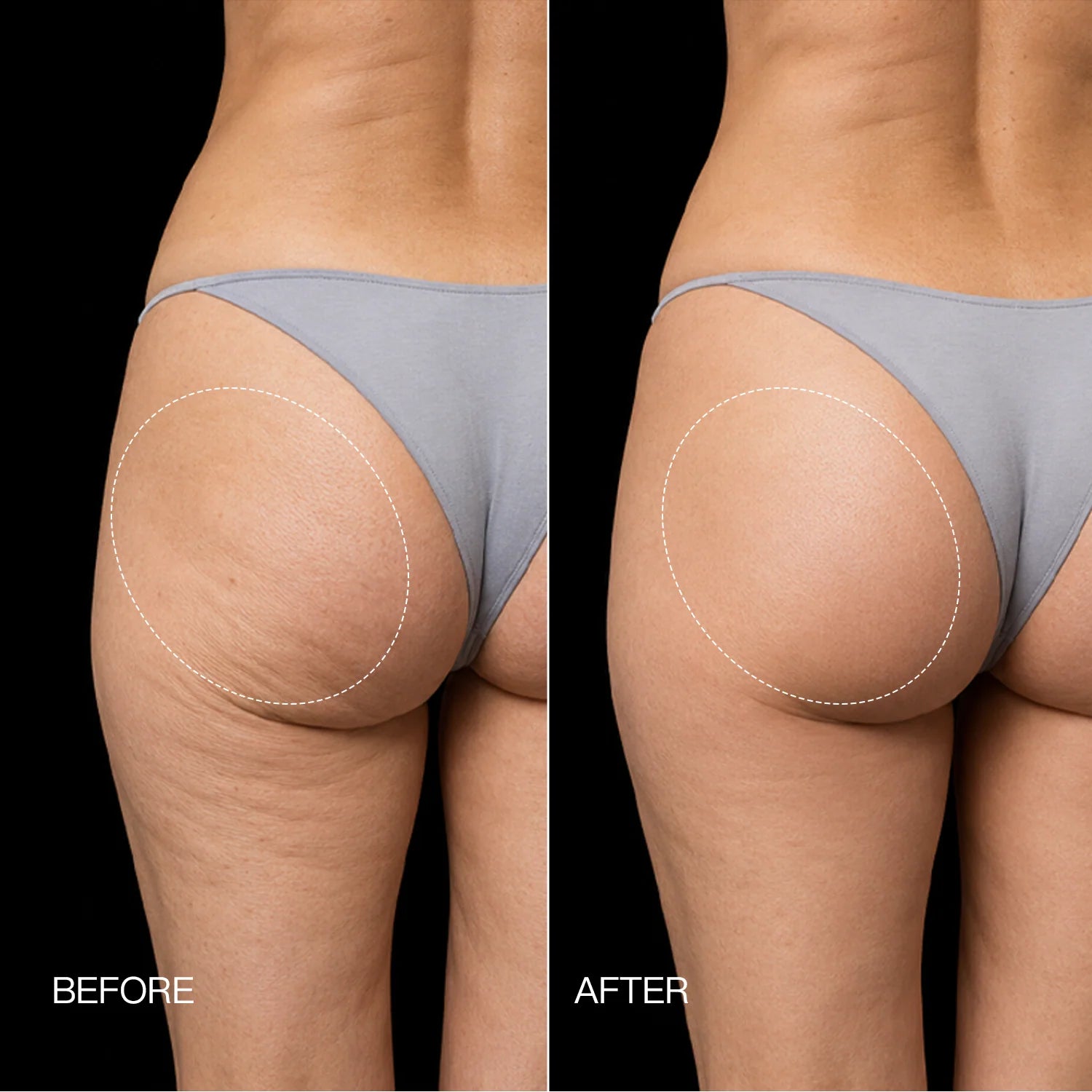 Calluve Toning Shorts