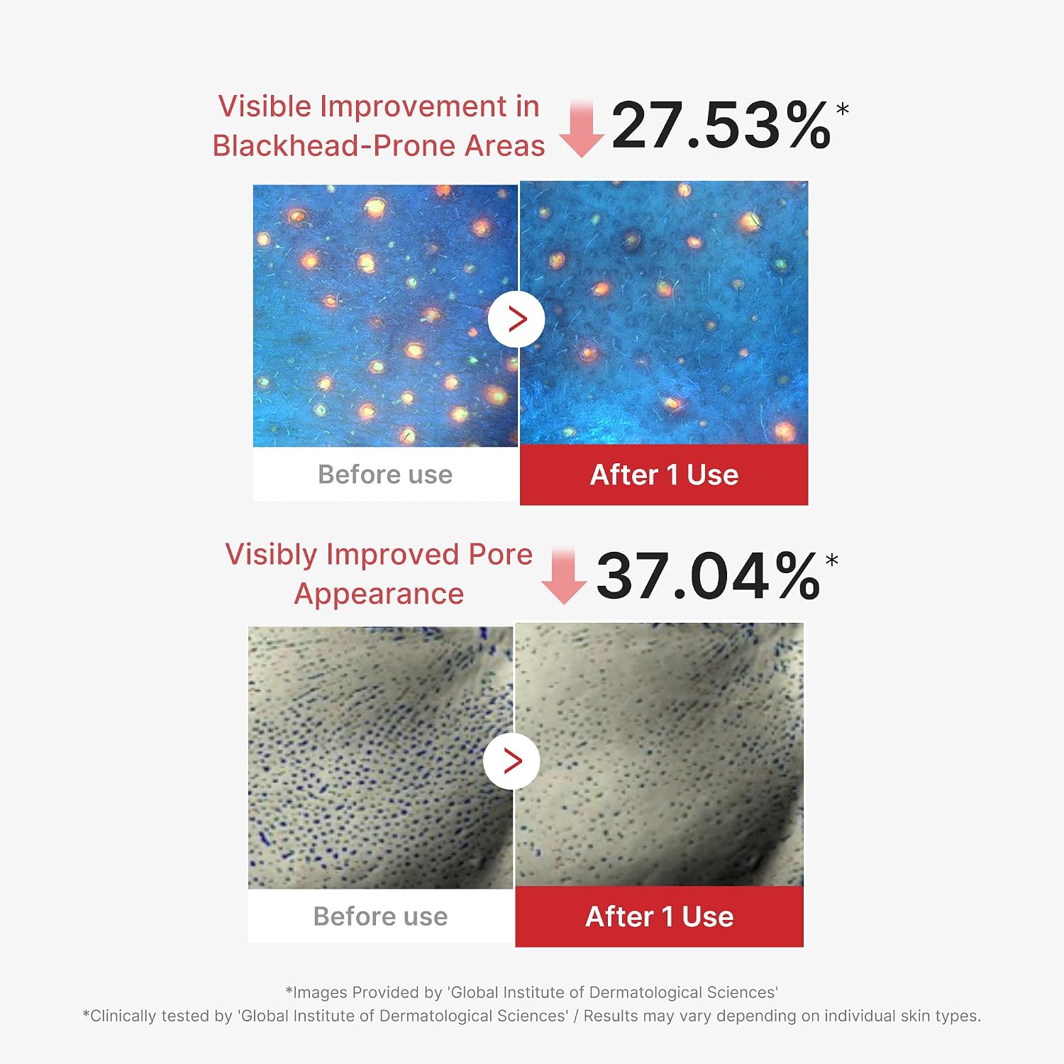 Calluve Sebum-Lift Peel Mask