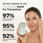 Calluve Red Light Under-Eye Reset