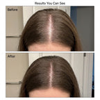 Calluve Roll-On Scalp Serum