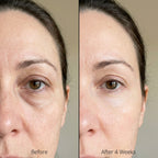 Calluve Red Light Under-Eye Reset