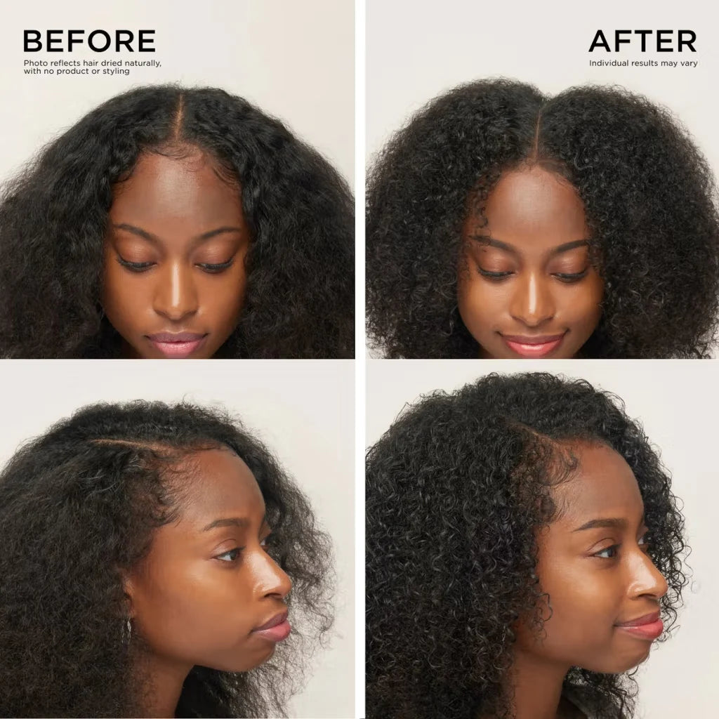 Not another miracle oil. A serious scalp formula you’ll actually want to use.