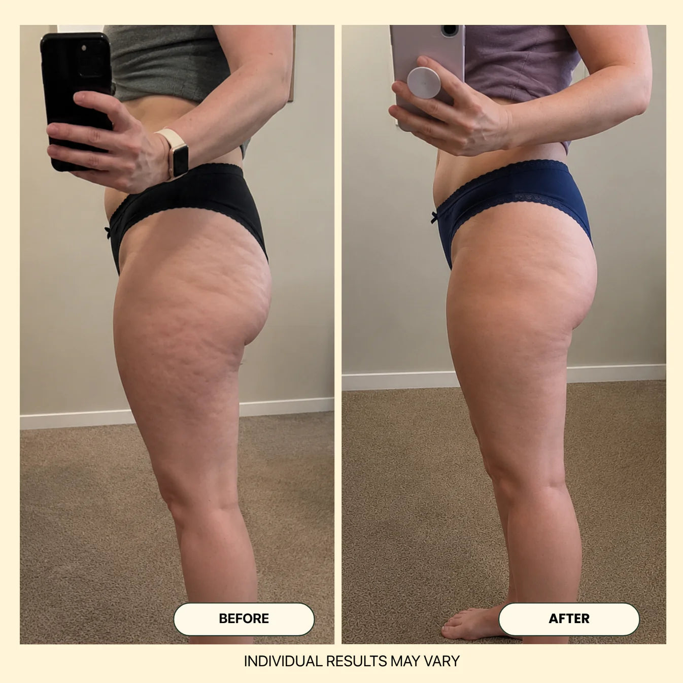 Calluve Gold Firming Gel