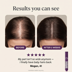 Calluve Roll-On Scalp Serum