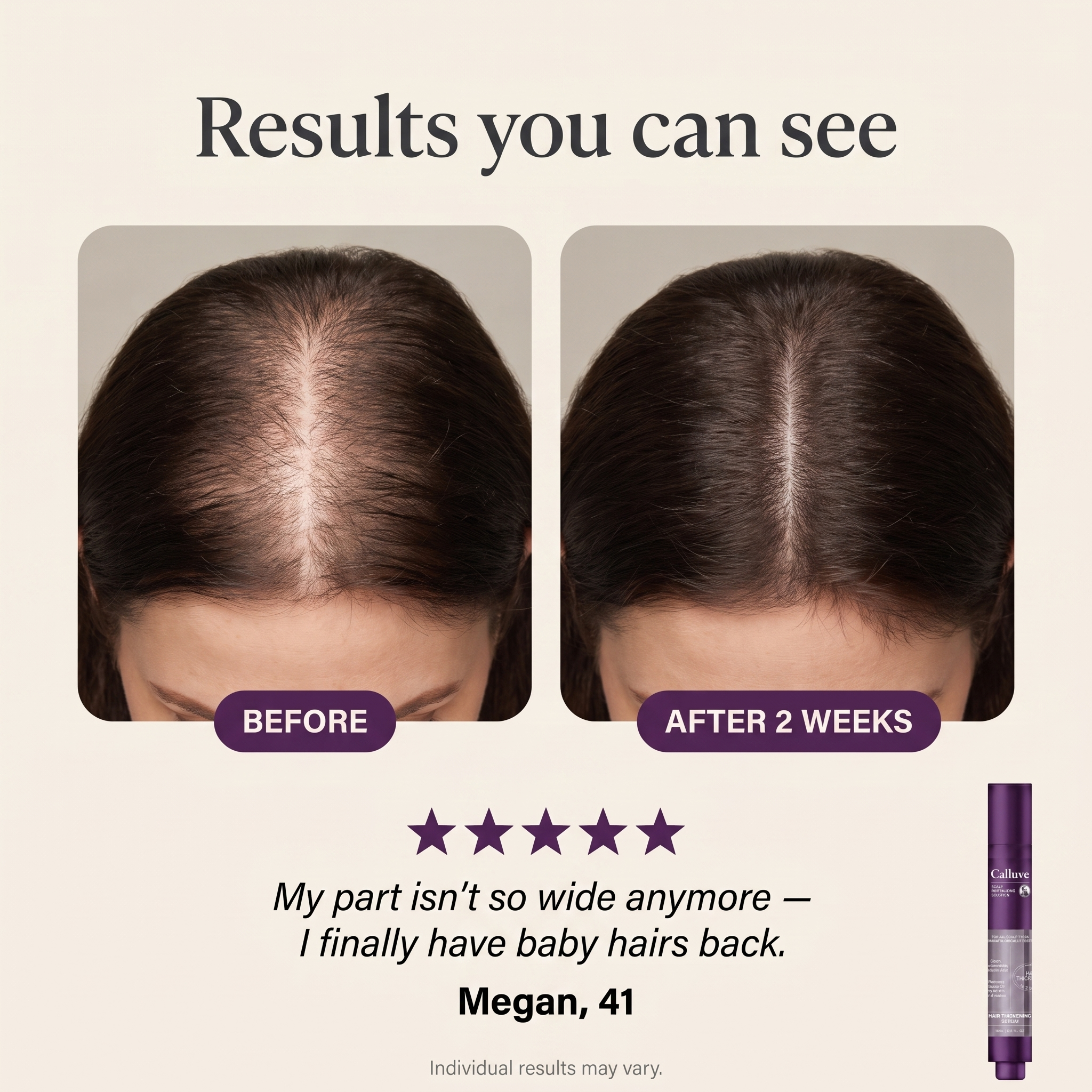 Calluve Roll-On Scalp Serum