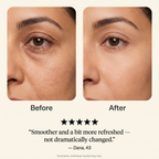 Calluve Red Light Under-Eye Reset