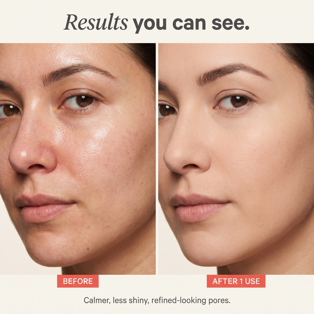 Your blackheads keep coming back because you keep stripping them.