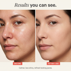 Calluve Sebum-Lift Peel Mask
