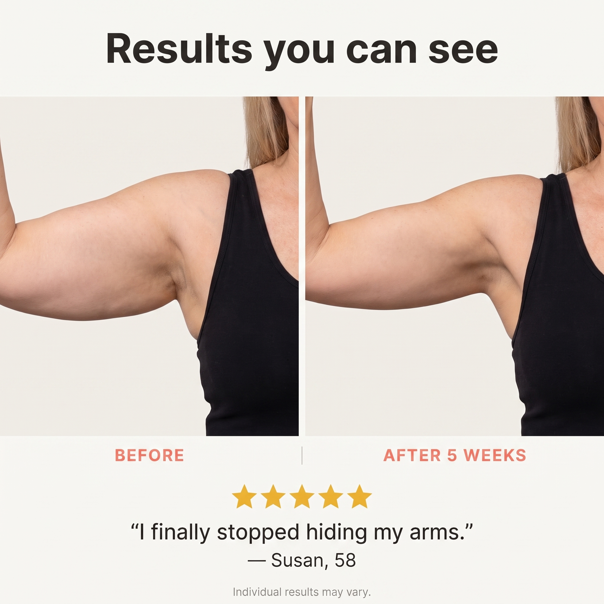 Calluve Halo Arm Toner
