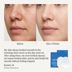 Calluve Rice Peel Pads
