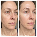 Calluve PDRN Pink Collagen Volume Multi-Balm
