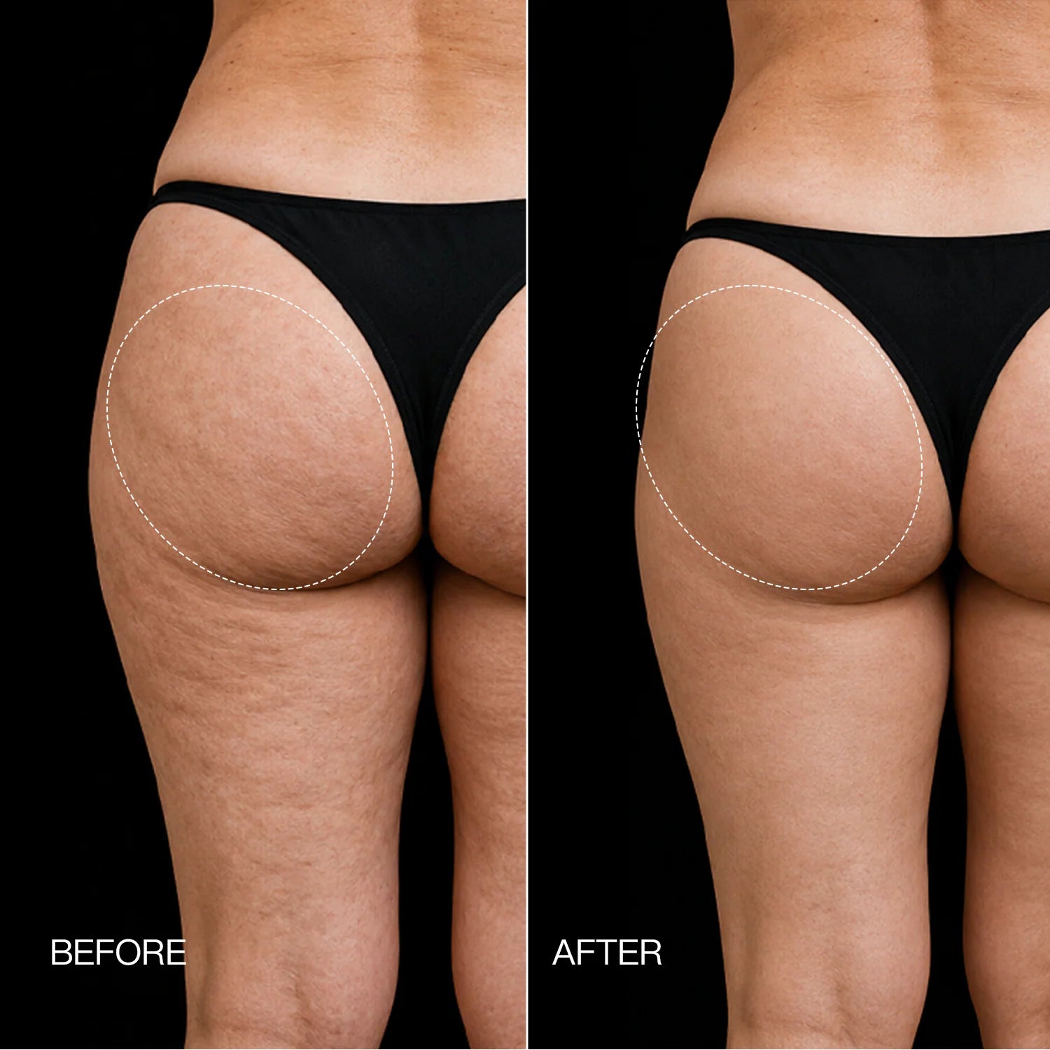 Calluve Toning Shorts