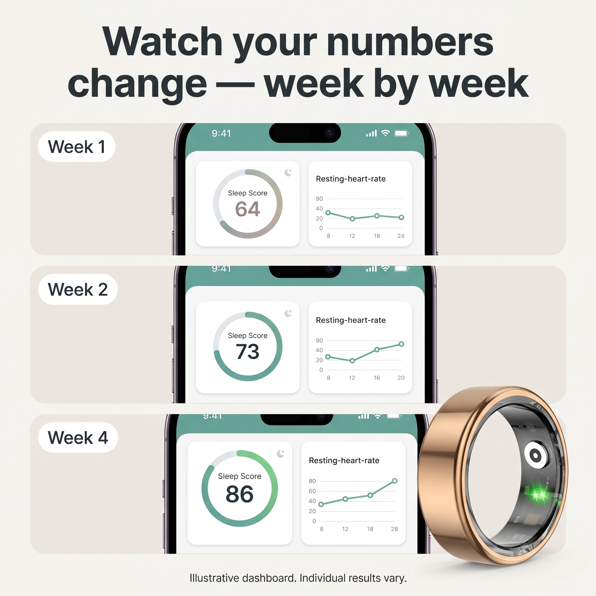 Calluve Vita Ring — Smart Health Tracking, No Subscription