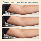 Calluve Flareguard™ — Cut-to-Fit Eczema Flare Patch