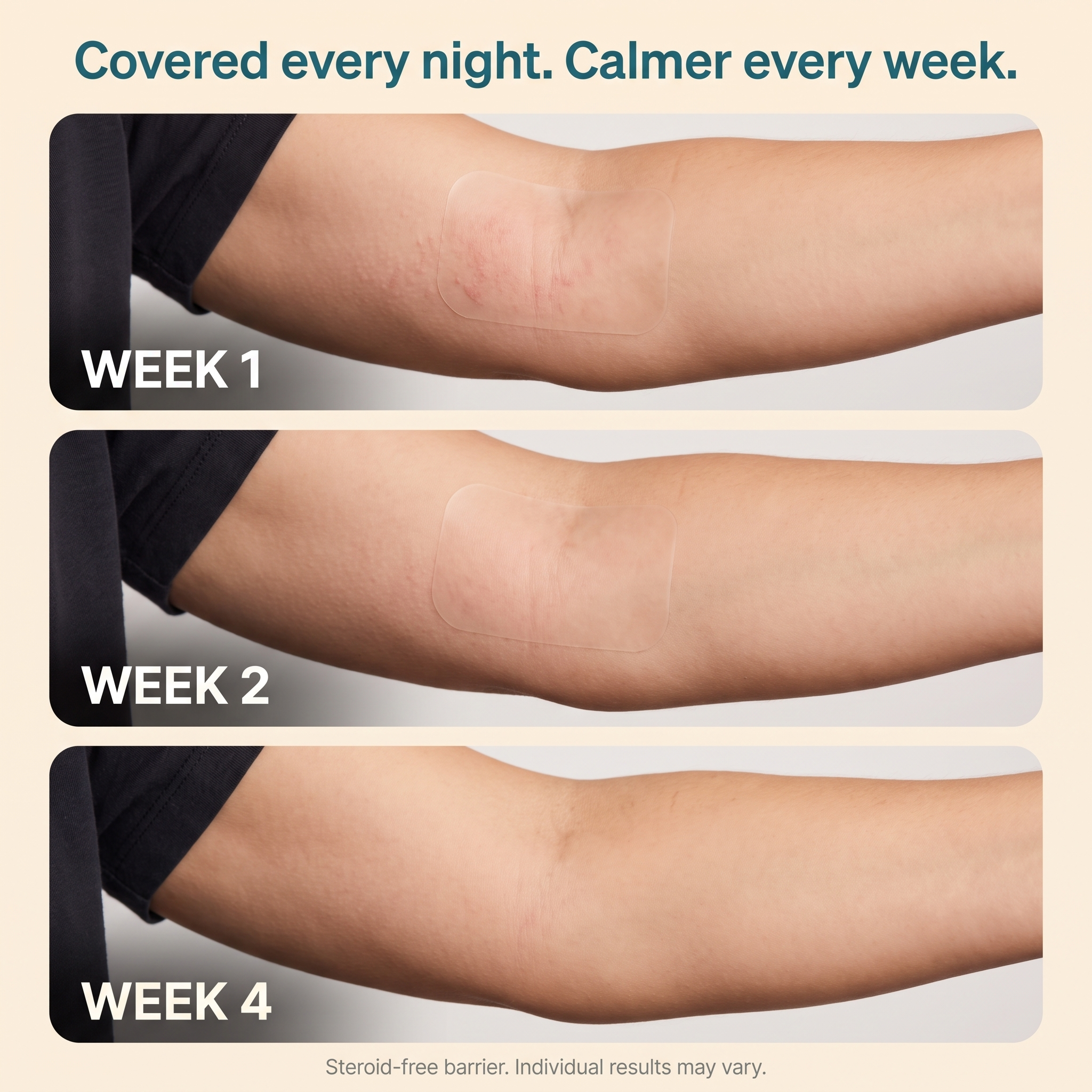 Calluve Flareguard™ — Cut-to-Fit Eczema Flare Patch