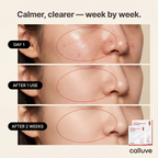 Calluve Sebum-Lift Peel Mask