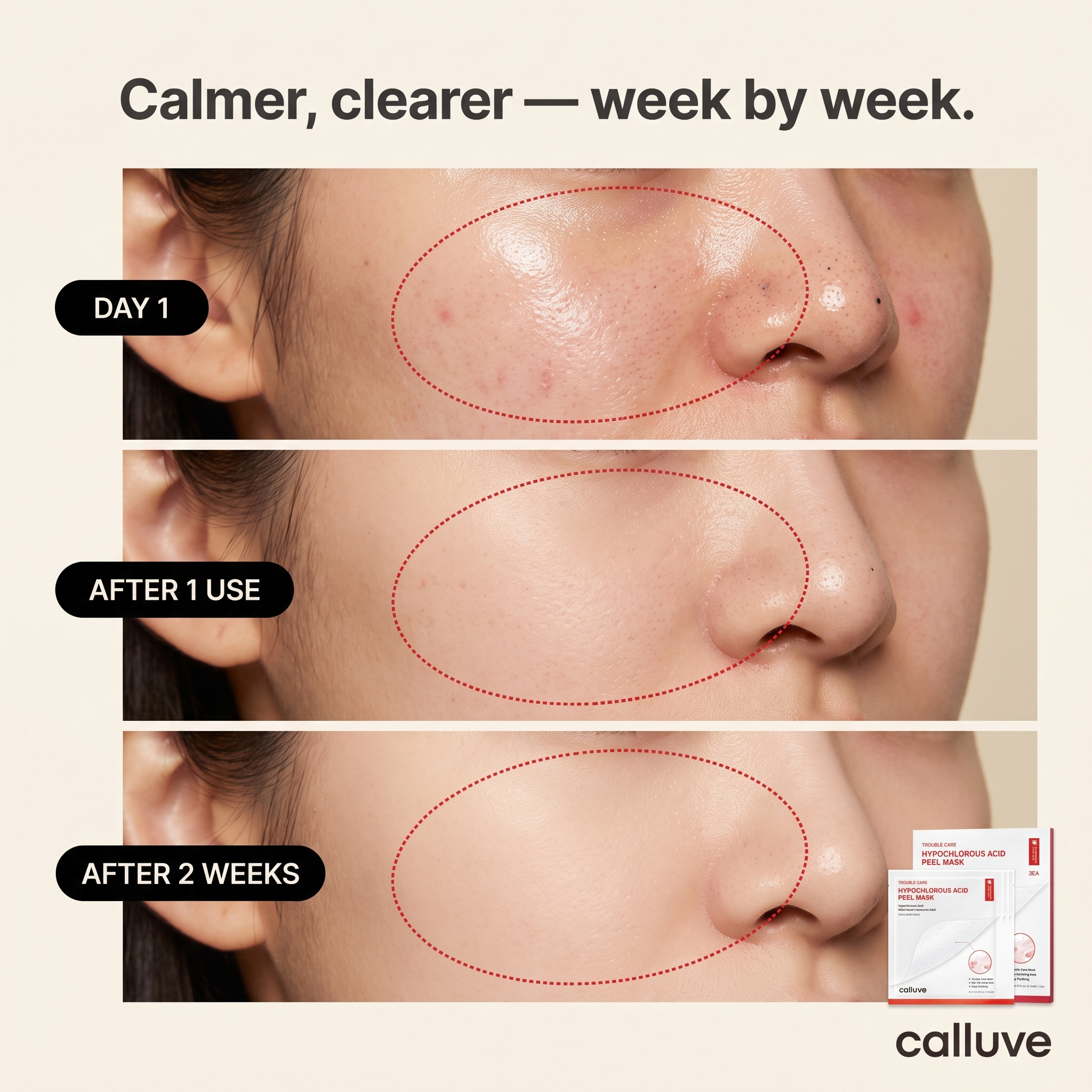 Calluve Sebum-Lift Peel Mask