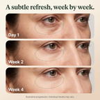 Calluve Red Light Under-Eye Reset