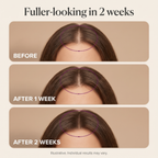 Calluve Roll-On Scalp Serum